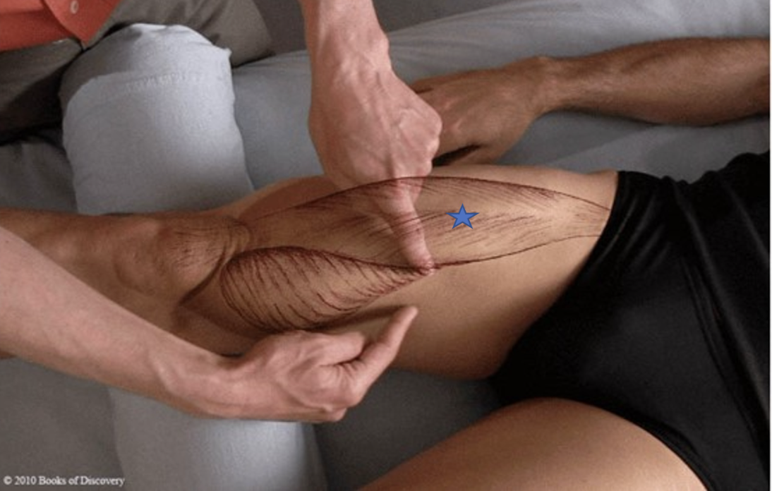 <p><span>From the list of muscles and actions below, identify the "starred" muscle and its primary actions.</span></p>