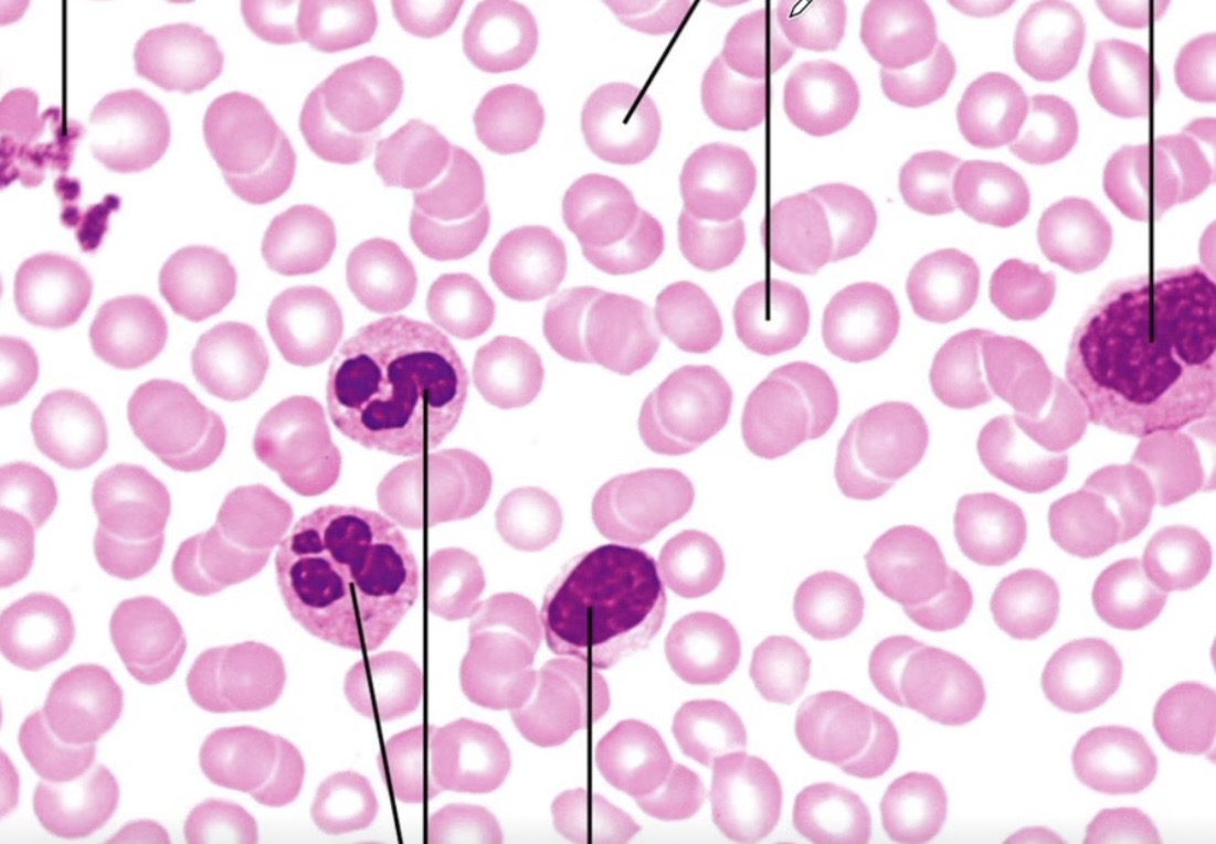 <p>What connective tissue is this? </p>
