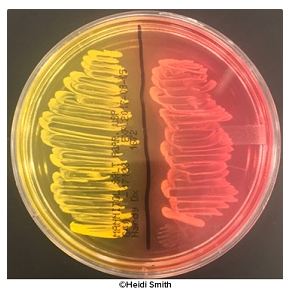 <p><span>Mannitol salt agar is defined as both a selective and a differential agar since it selects against non-halophiles and allows the researcher to distinguish between organisms that vary in their ability to ferment mannitol.&nbsp;T/F</span></p>