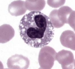 <p>What neutrophilic change is present here?</p>