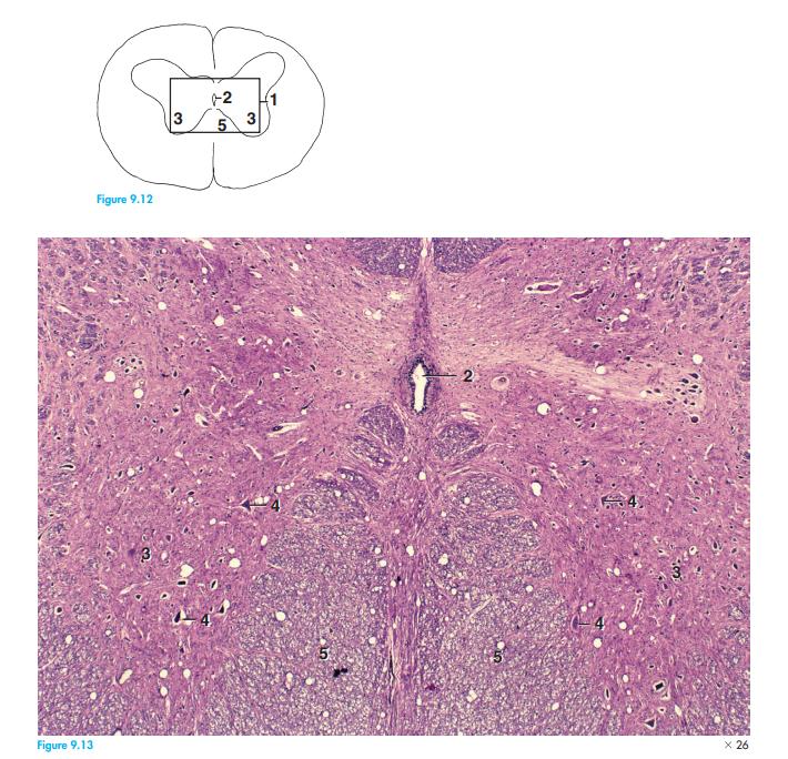 <p>Part and Stain?</p>