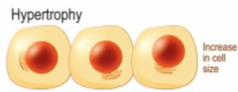 <p>increased muscle cell size (diameter/length) </p>
