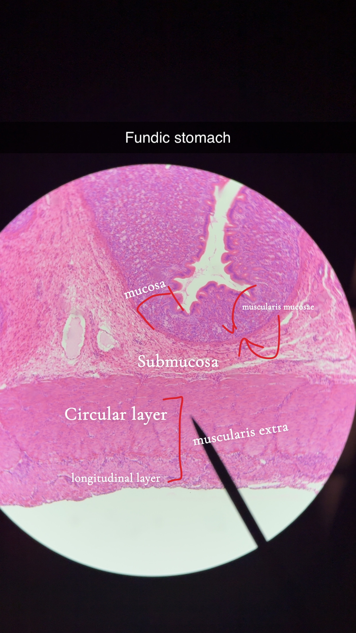 <p>dome shaped area</p><p></p><p>parietal cells- HCL, intrinsic factors, red stained</p><p></p><p>chief cells- pepsinogen, blue stained </p>