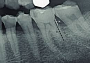 <p>Partial Image </p><p><strong>What it looks like:</strong><br>Only part of the teeth appear.</p>