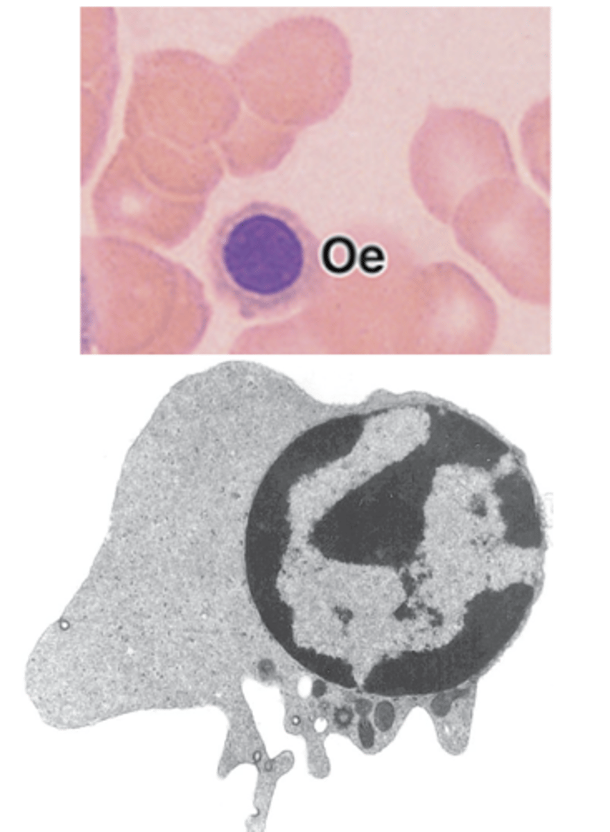 <p>What is another name for the orthochromatophilic erythroblast?</p>