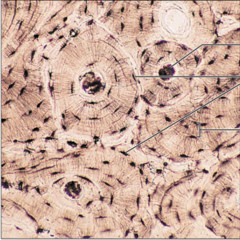 <p>name the tissue: hard, calcified matrix containing many collagen fibers; osteocytes lie in lacunae. Very well vascularized.</p>