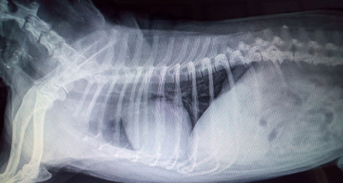 <p>Bronchopneumonia</p>