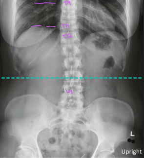 <p>Upright Abdomen: Is this Image Good?</p>