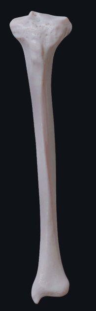 <p>Identify the bone</p>