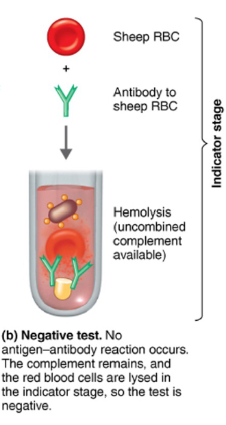 <p>3. As a test indicator, Sheep RBCs are introduced into the</p><p>patient’s serum sample. Antibodies against the sheep’s RBCs</p><p>are also introduced into the patient’s serum sample. An immune</p><p>complex will form between the Sheep’s RBC and the Antibodies</p><p>against the Sheep’s RBCs</p><p>4. Hemolysis of the Sheep’s RBCs occur because complements</p><p>get activated and compliment fixation now occurs (All available</p><p>compliments bind to the stem region of the antibody against the</p><p>sheep’s RBCs). Compliment can bind to these antibodies</p><p>because they were not “used-up” nor fixed during the</p><p>compliment fixation stage (No immune complex was formed in</p><p>this stage, No patient Antibodies). Hemolysis of sheep RBCs</p><p>indicate a negative test for the Patient’s Antibodies,</p><p>therefore the patient is negative for the diseaseBre</p>