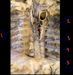 <p>What is labeled 2?</p>