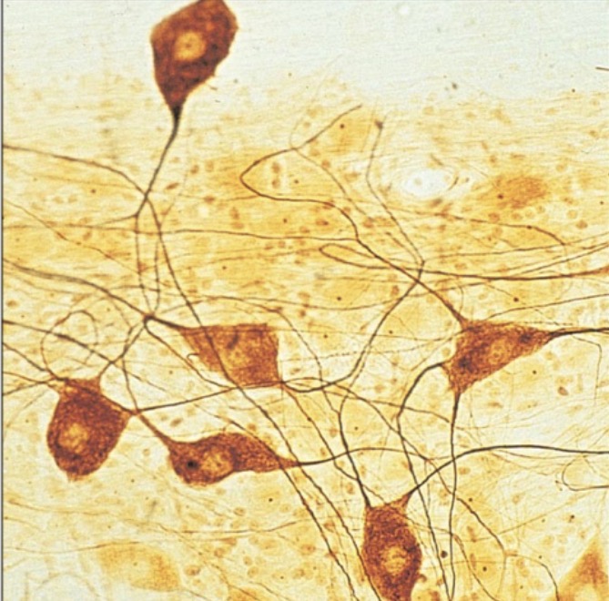 <p>what is the name of this tissue?</p>