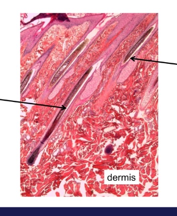 <p>What two different stages of hair growth are these hairs in?</p>