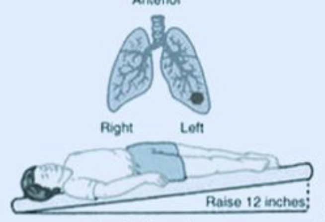 <p>What position is this?</p>