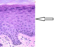 <p>The epidermal layer several cells thick containing spiny keratinocytes and Langerhans (dendritic) cells.</p>