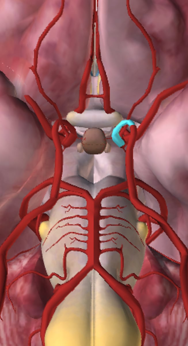 <p>Internal carotid (left)</p>
