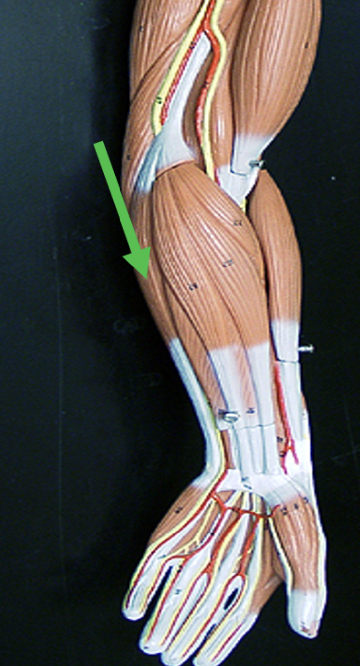 <p>Identify the muscle indicated by the pointer.</p>