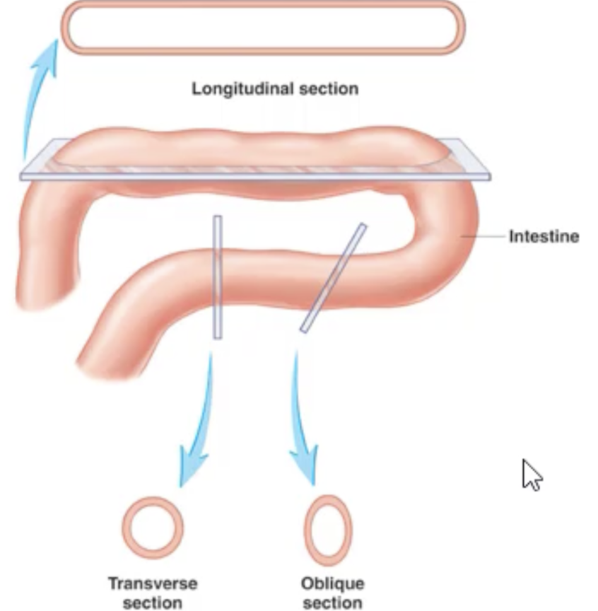 <p>Longitudinal Section/Plane</p><ul><li><p>Cut along length </p></li></ul><p></p><p>Cross/Transverse </p><ul><li><p>Cut at right ankle to longitudinal section of length of organ</p></li></ul><p></p><p>Oblique</p><ul><li><p>Cut at any angle but right angle</p></li></ul><p></p>