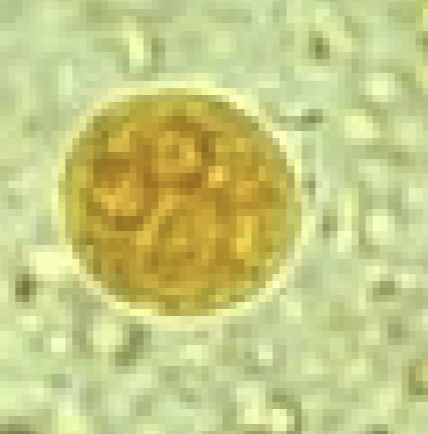<p>What protist/cyst is this?</p>
