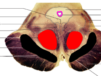 <p>What view is this ? Label structures </p>