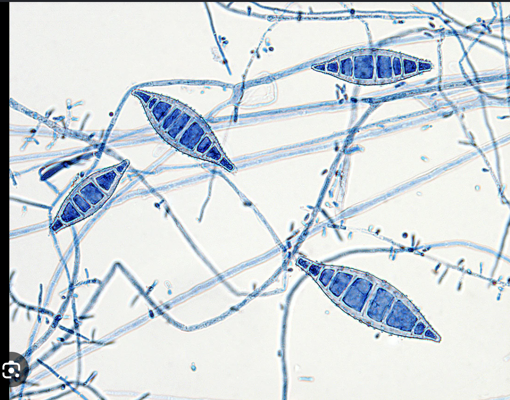 <p>-Skin and scalp infections usually from pets</p><p>-Colony surface is white with yellow edges</p><p>-Spindly, rought macroconidia with >6 cells/compartments</p>