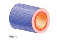 <p>Internal diameter (lumen) vs. wall thickness</p>