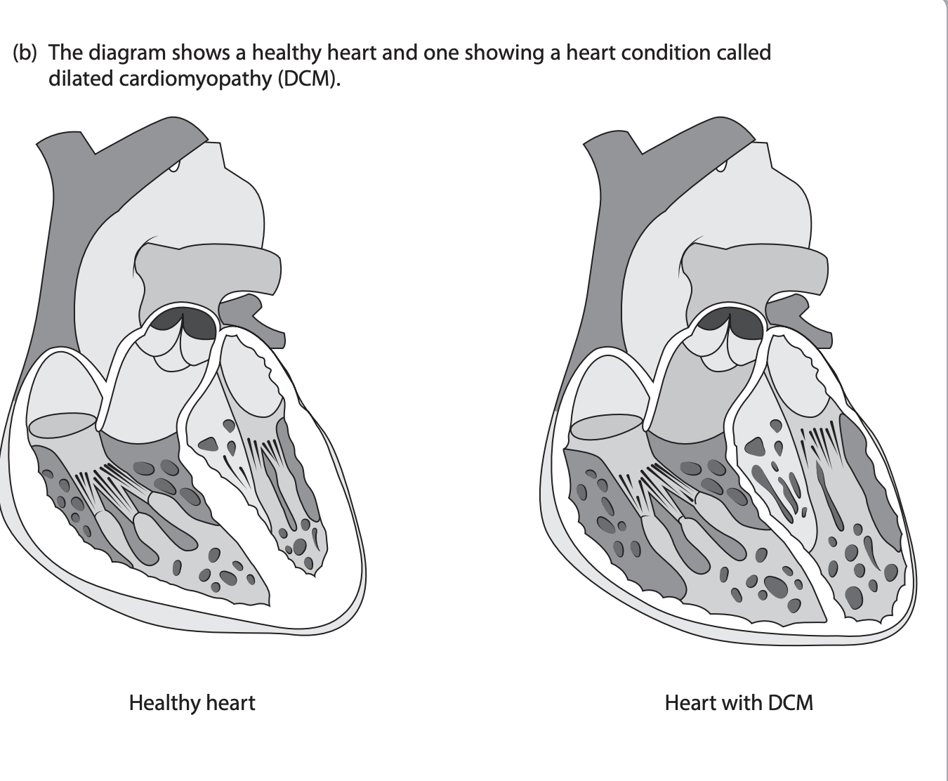 <p>Compare and contrast the structures of these two hearts. (4)</p>