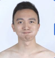 <p>Have pt puff cheeks then press to see if air escapes equally</p>