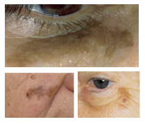 <p>What is the most likely diagnosis ?</p>