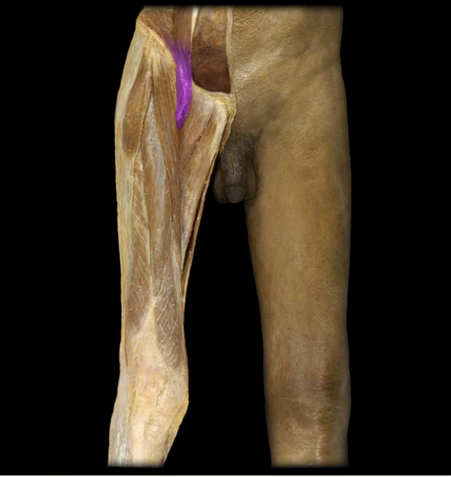 <p>What muscle is this?</p>