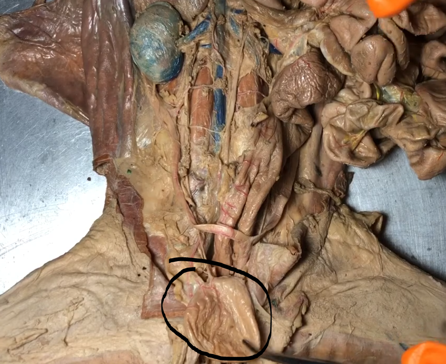 <p>What is this structure</p>