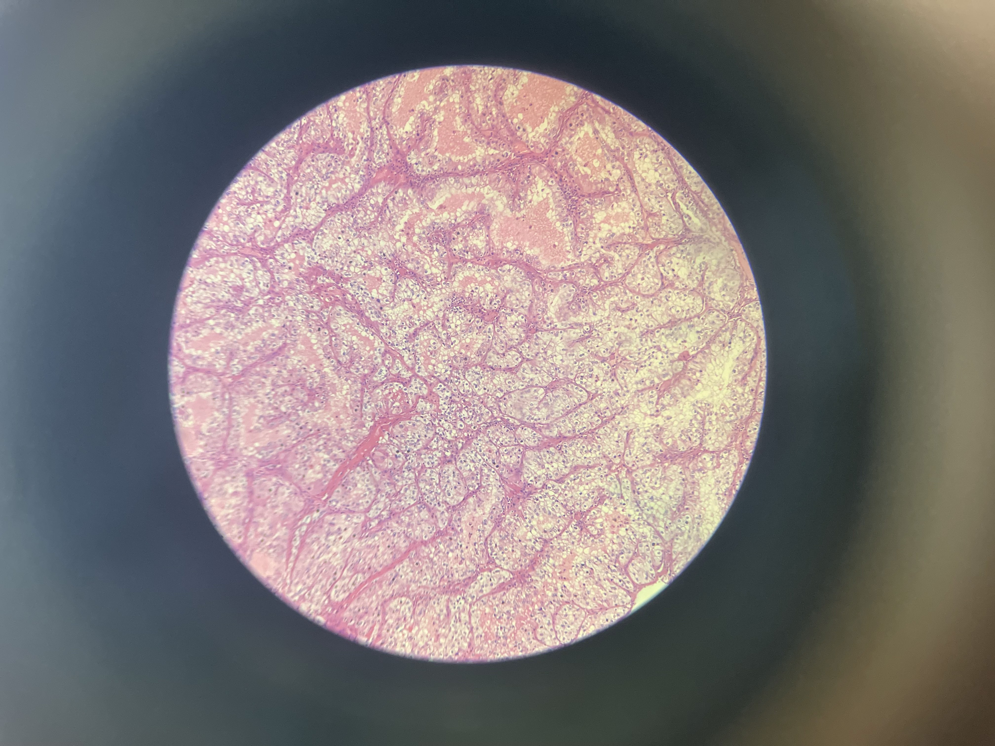 <p>What is the diagnosis?</p>