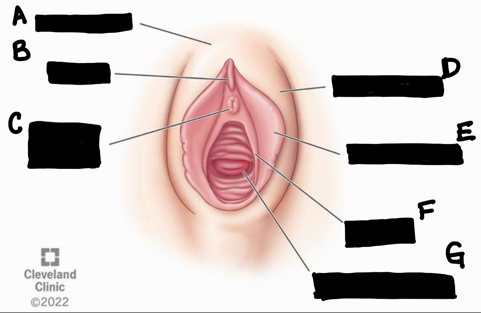 <p>What is the structure labeled “E”?</p>