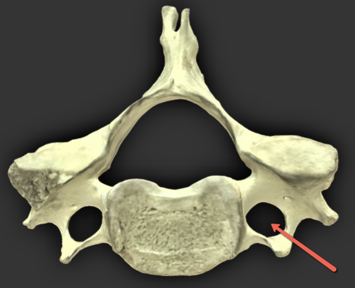 <p><span><strong>Identify the bone marking indicated by the pointer.</strong></span></p>