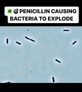 <p>Many PG <strong>biosynthesis enzymes are essential</strong>. <strong>Inhibiting</strong> these enzymes can<strong> lead to bacterial cell death.</strong></p>
