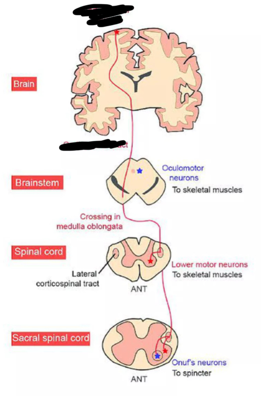 <p>What tract is this?</p>