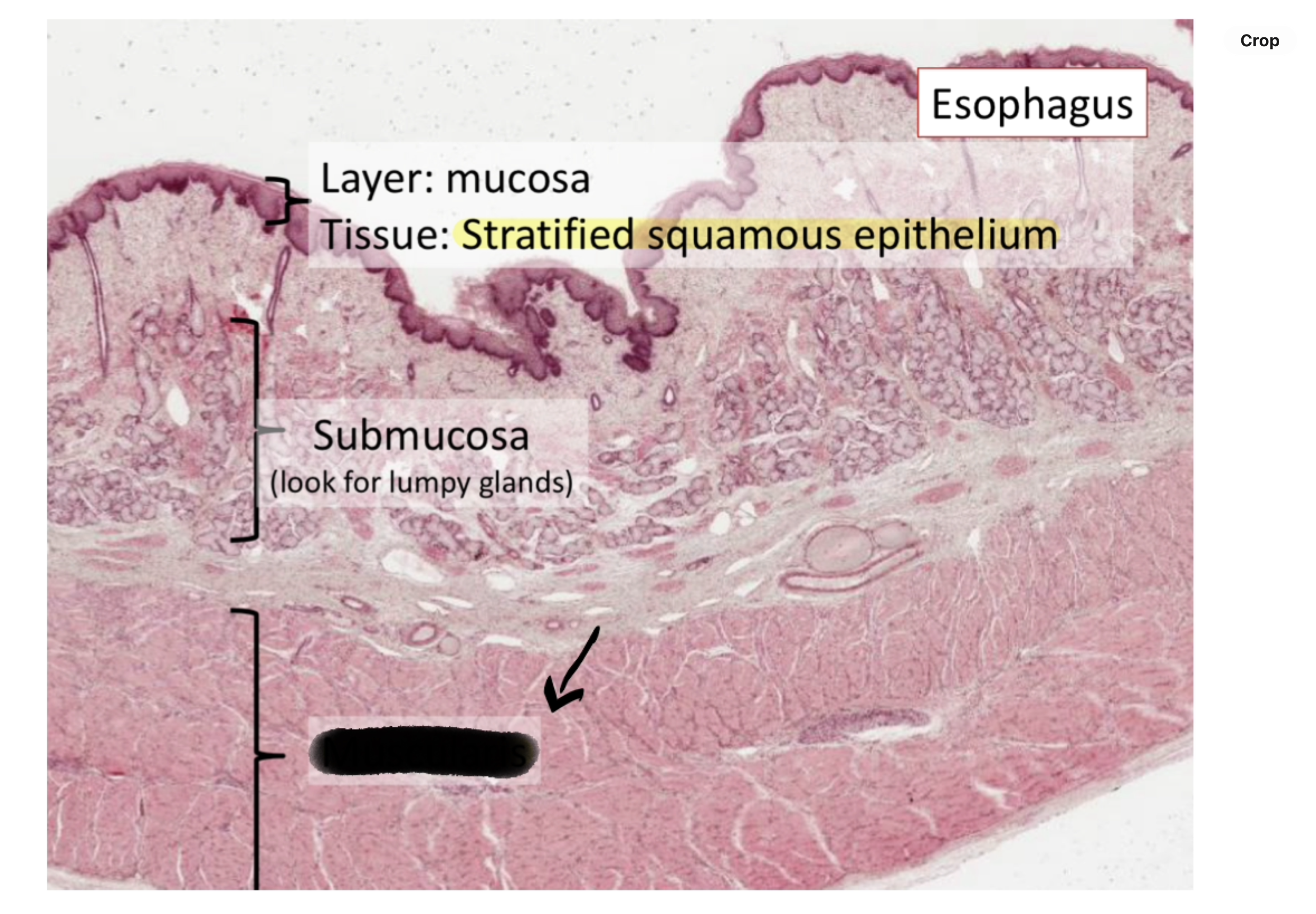 <p>muscularis of the esophagus</p>