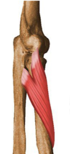<p>What muscle is being shown?</p>