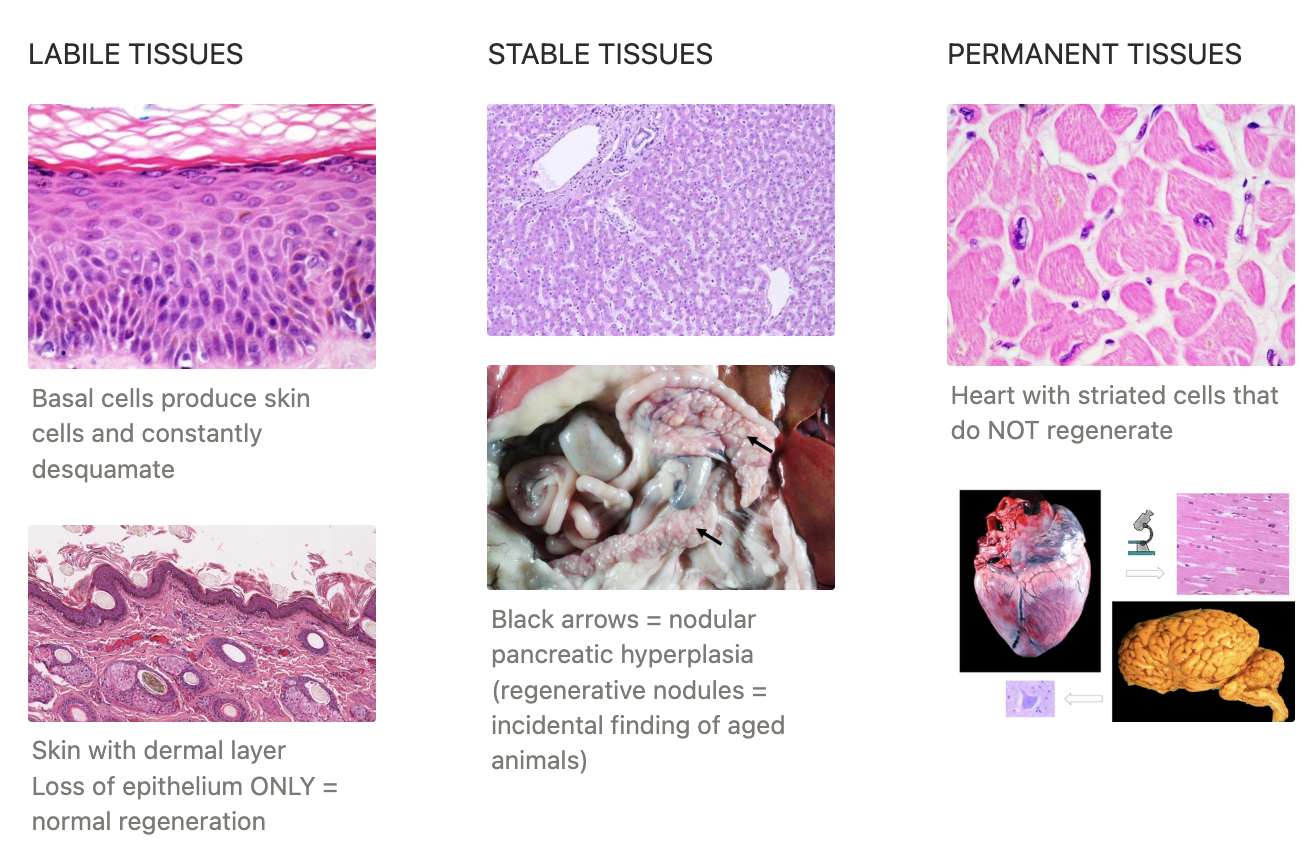 <p><strong><u>ONE: LABILE TISSUES</u></strong></p><p><u>Definition:</u> Contain undifferentiated stem cells that are continuously diving and proliferate throughout their life, replacing those that are lost</p><p><u>Examples:</u></p><ol><li><p>Mucosal epithelium</p></li><li><p>Bone marrow cells and haematopoietic tissues</p></li></ol><p></p><p><strong><u>TWO: STABLE TISSUES</u></strong></p><p><u>Definition:</u> Contain quiescent cells with low levels of replication </p><ul><li><p>The cells are usually in the rest phase of the cell cycle, but undergo rapid division in response to injury (stimulated by growth factors)</p></li></ul><p><u>Examples:</u></p><ol><li><p>Mesenchymal cells</p></li><li><p>Vascular endothelial cells</p></li><li><p>Parenchymal cells of the liver, kidneys and pancreas</p></li></ol><p></p><p><strong><u>THREE: PERMANENT TISSUES</u></strong></p><p><u>Definition:</u> Terminally differentiated non-proliferative cells</p><ul><li><p>Damage to these cells will result in loss of function as they repair by scar tissue formation</p></li></ul><p><u>Examples:</u> </p><ol><li><p>Cardiac cells</p></li><li><p>Nervous tissue</p></li></ol><p></p>