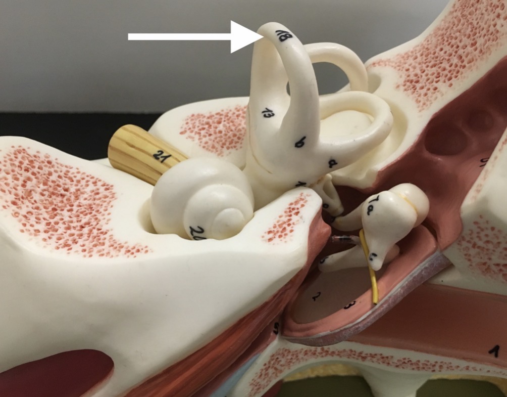 <p><span>name of the specific structure at the end of the arrow's point</span></p>