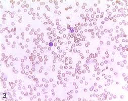 <p>which type of connective tissue is shown</p>