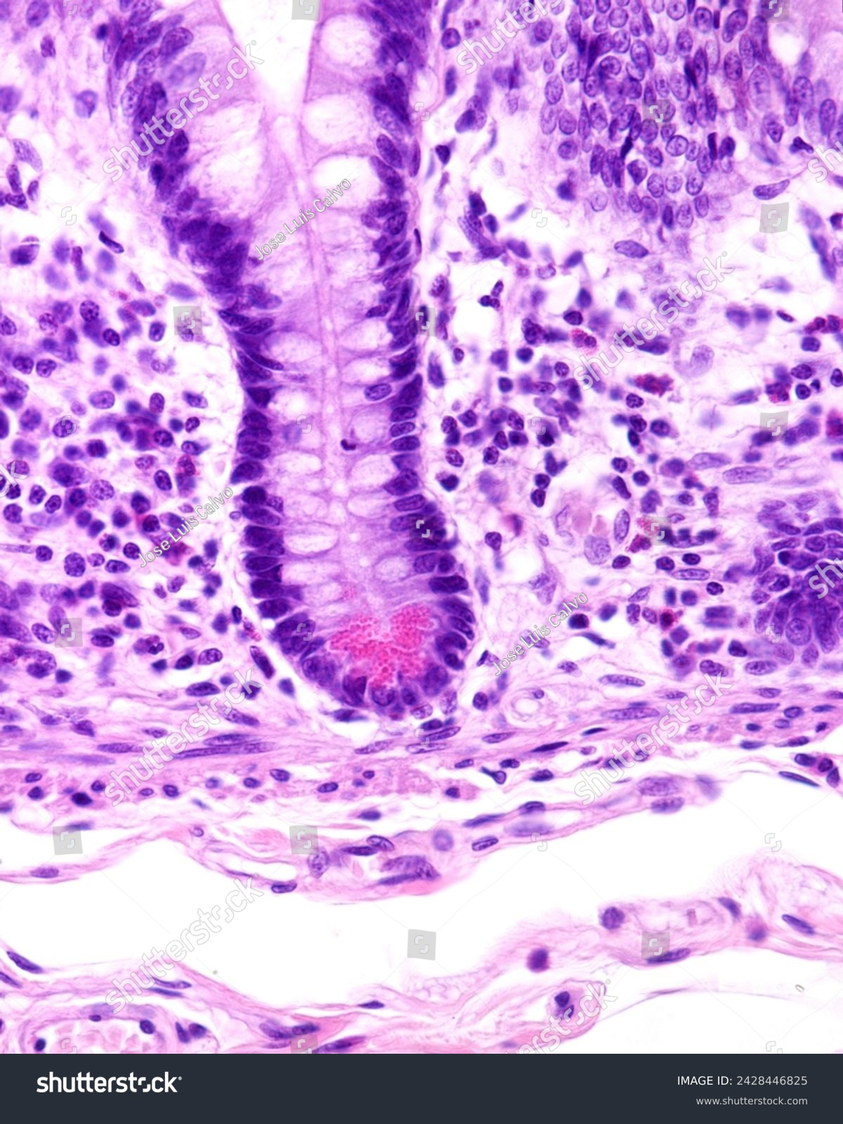 <p>Células intestinales que se encuentran en porción basal de las criptas y están especializadas en secreción de lisosima, fosfolipasas y defensinas:</p>