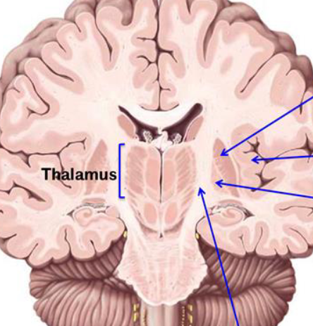 <p>Can you label this coronal section of the brain?</p>