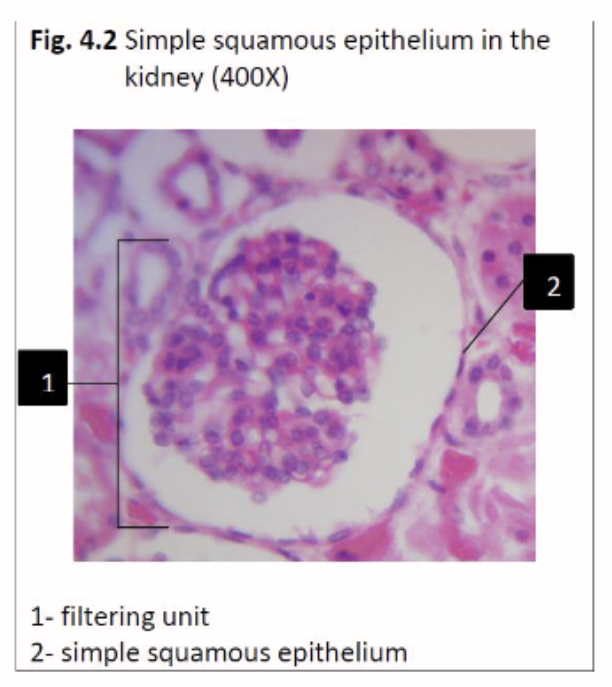 <p>Simple Squamous epithelium</p><p>Located: <span>Alveoli of lungs, glomerular</span><br><span>capsule of kidney (filtration</span><br><span>membrane), endothelium of blood</span><br><span>vessels</span></p>
