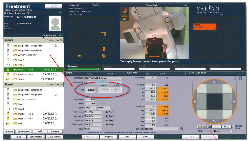 <p>Monitor Units (MU)</p><ul><li><p>MU is the length of time a unit is physically on to deliver a prescribed dose. The MU is the <u>treatment “time”</u> for a linear accelerator. </p></li><li><p>Linear accelerators are calibrated so that <u>1 MU delivers 1cGy</u> for a standard source to calibration point</p></li></ul><p></p>