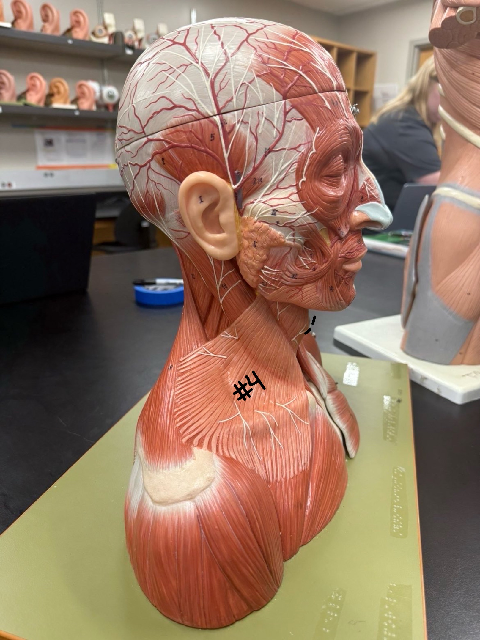 <p>What muscle is labeled at #4?</p>