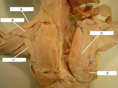<p>A</p>