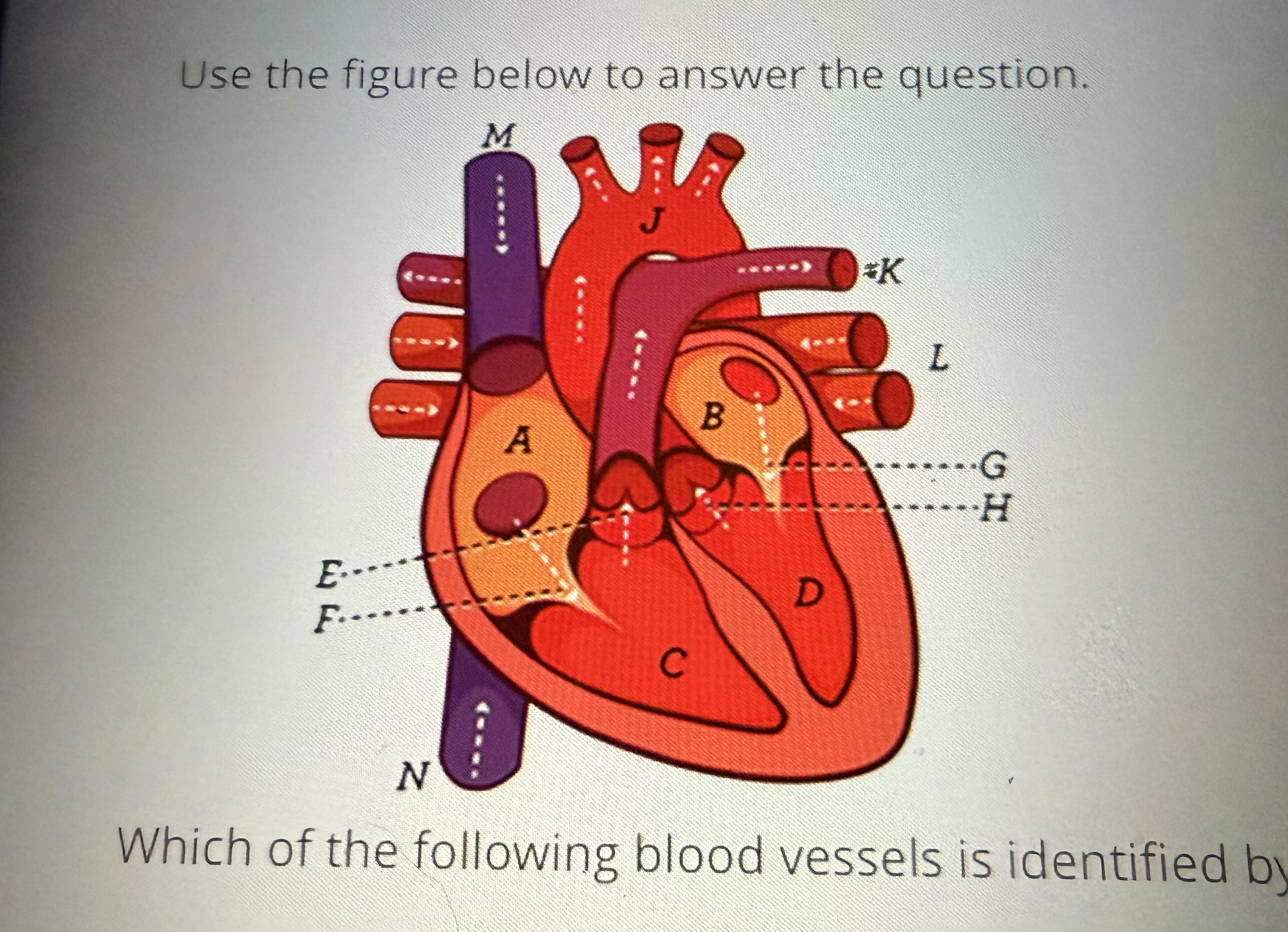 <p>Pulmonary Artery - Identified by the letter “K”</p>