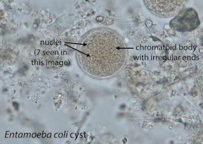 <p><em>Entamoeba coli</em></p><p><strong>CYST</strong></p><p>chromatoidal body visible</p>