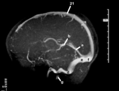 <p>Radiograph sinuses: b</p>